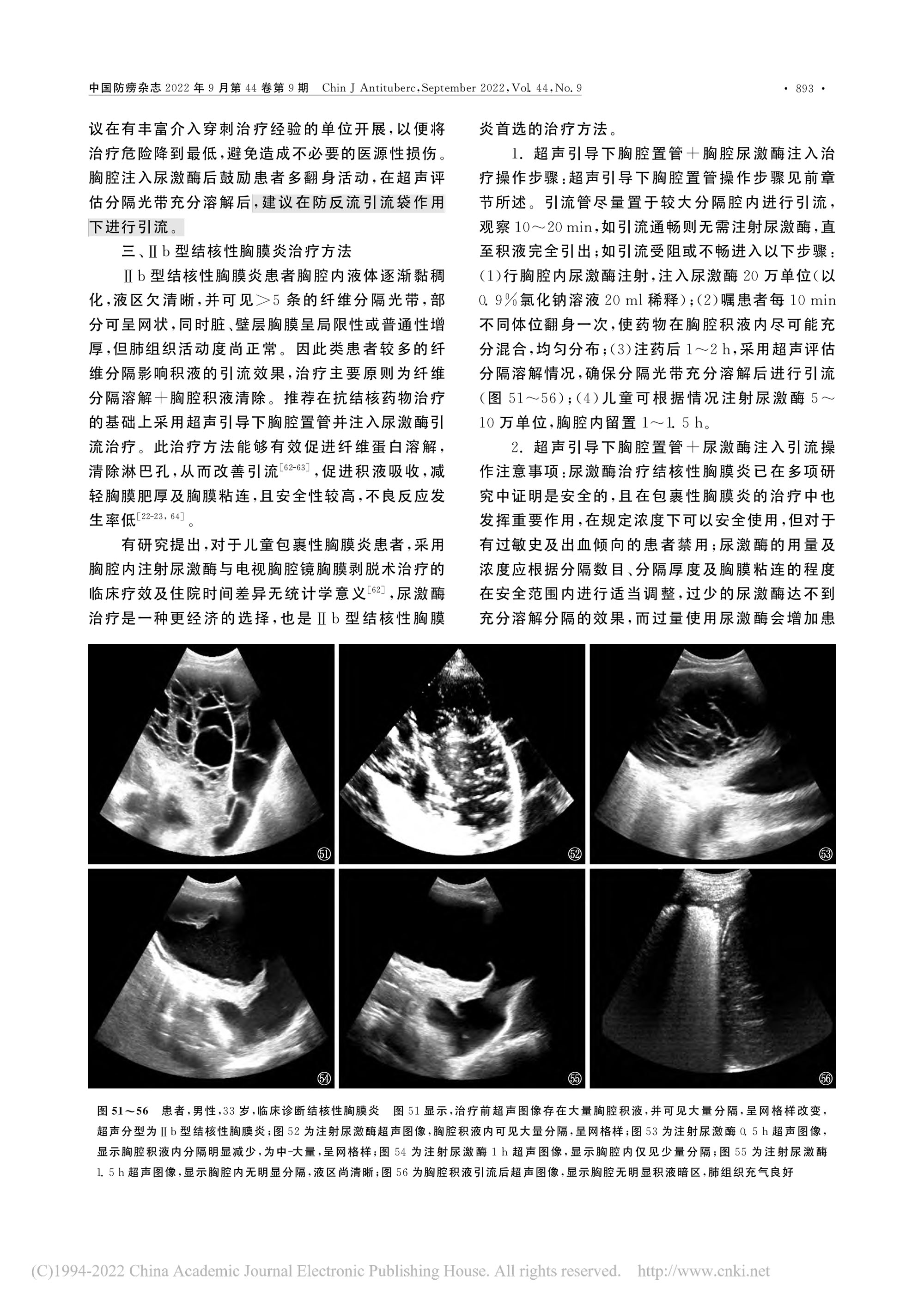 2022结核性胸膜炎超声诊断、分型及介入治疗专家共识(2022年版)-14.jpg