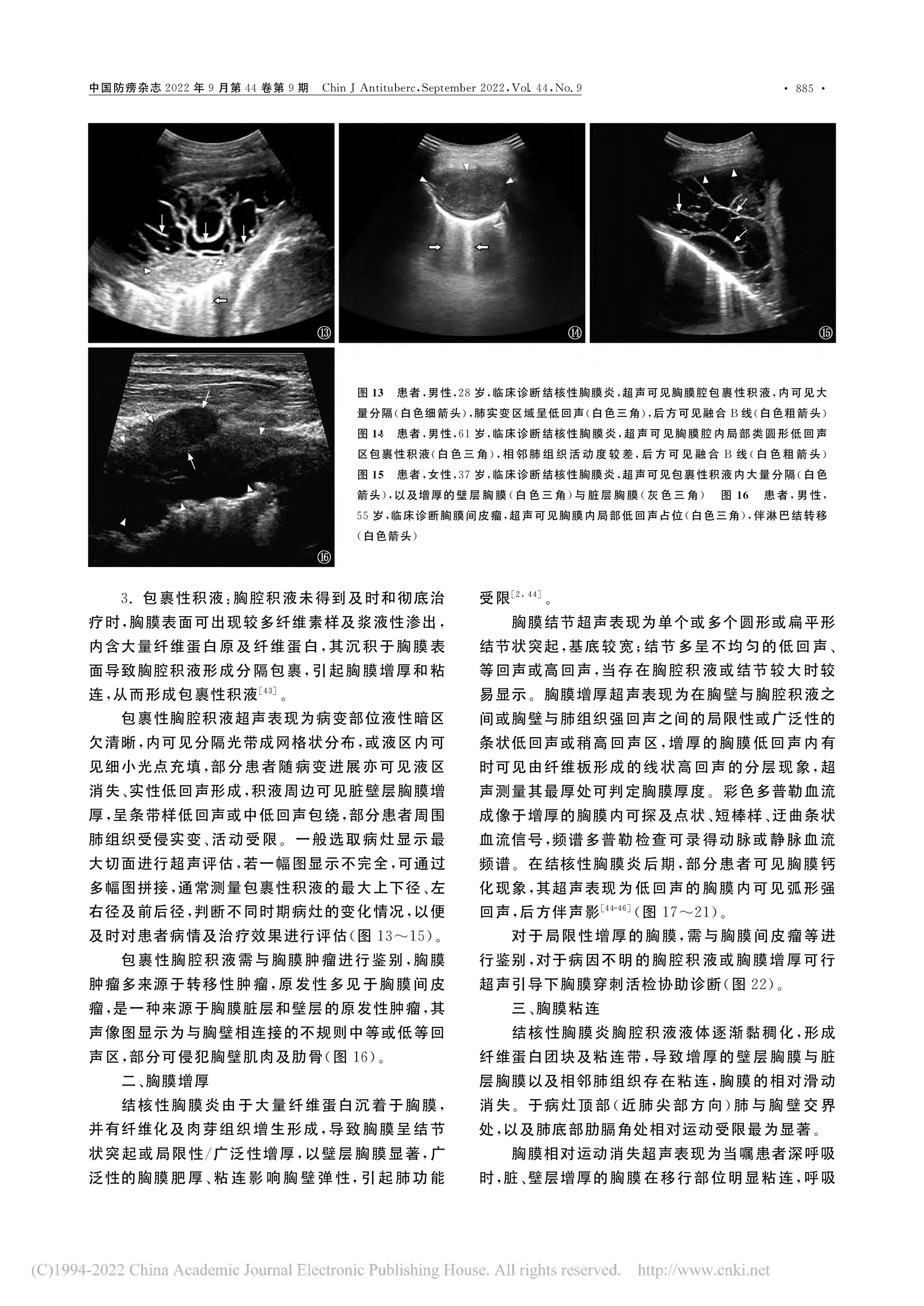 2022结核性胸膜炎超声诊断、分型及介入治疗专家共识(2022年版)-6.jpg