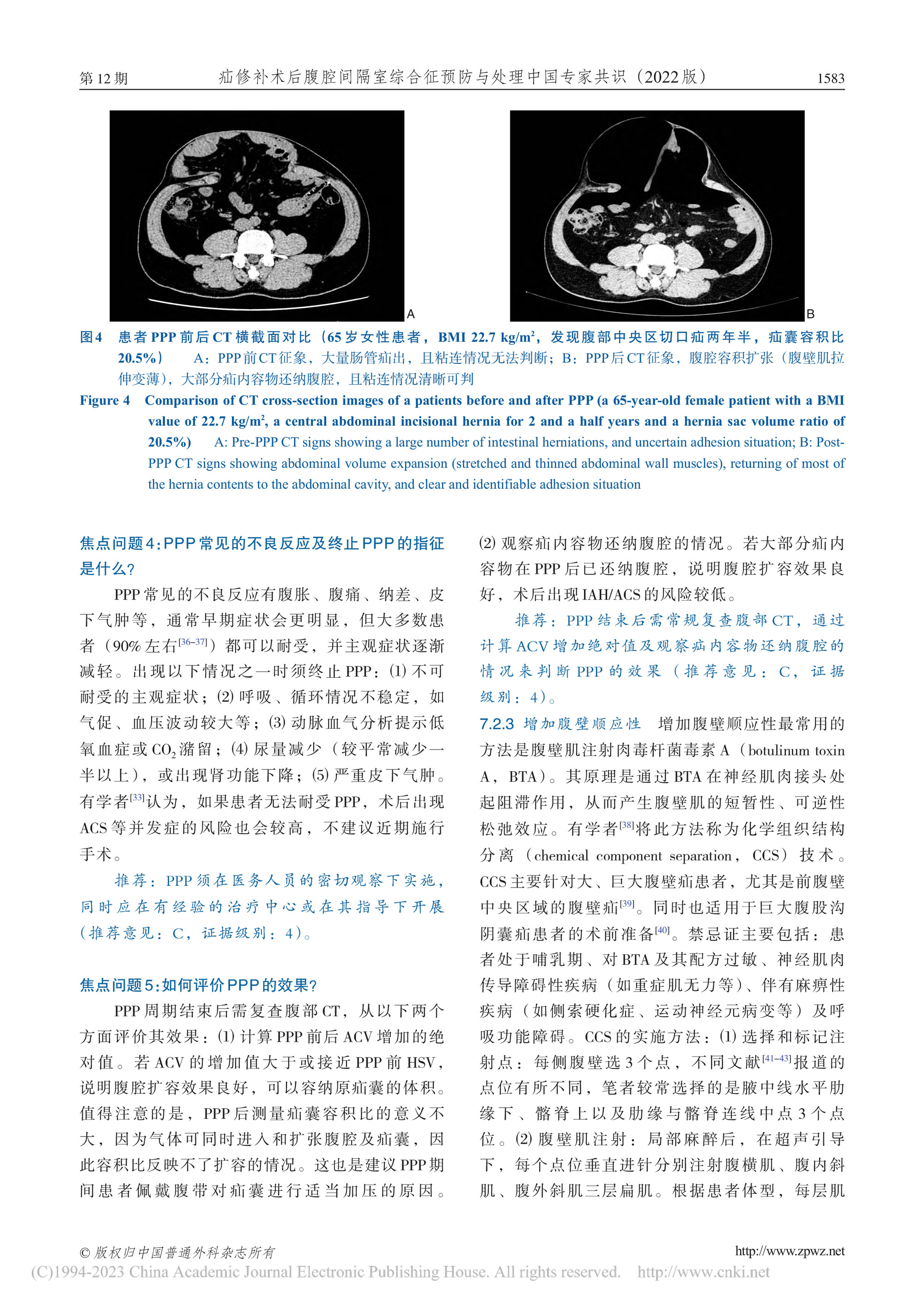 2022-疝修补术后腹腔间隔室综合征预防与处理中国专家共识-6.jpg