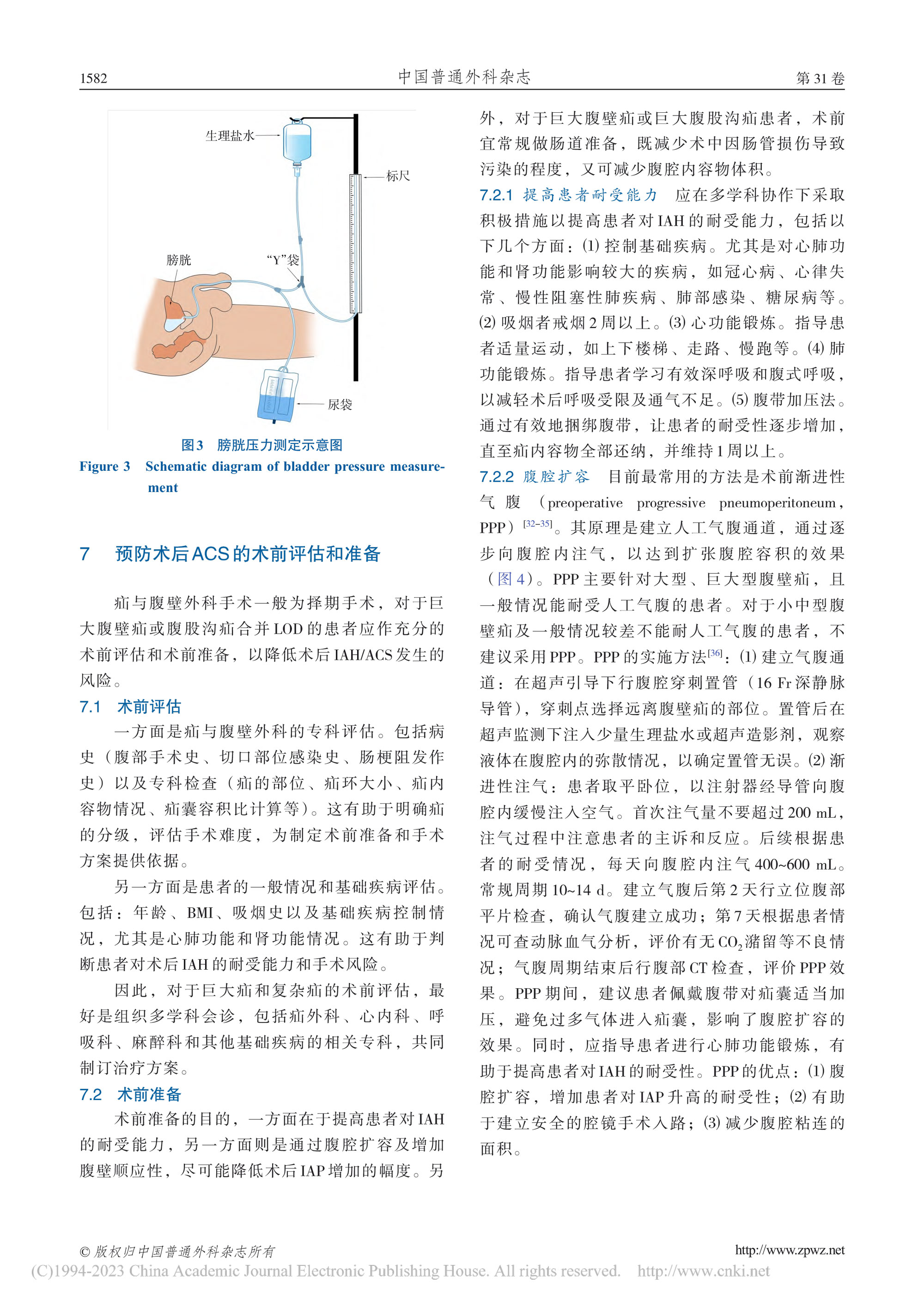 2022-疝修补术后腹腔间隔室综合征预防与处理中国专家共识-5.jpg